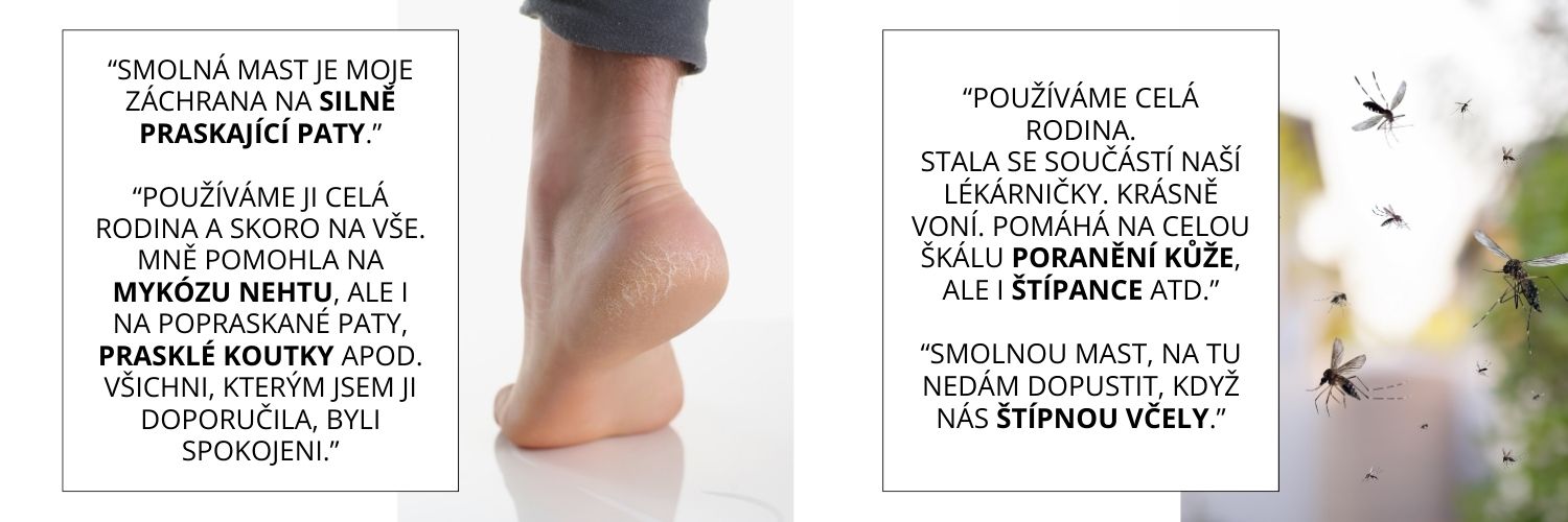 “Smolná mast je moje záchrana na silně praskající paty.” (300 x 210 px) (1500 x 500 px)